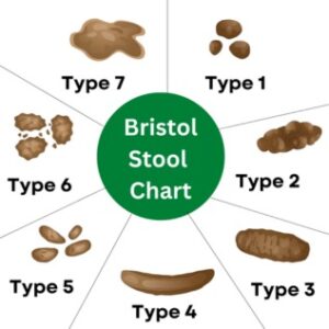 Bristol Stool Chart 